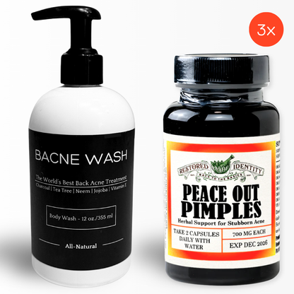 bacne wash and peace out pimples