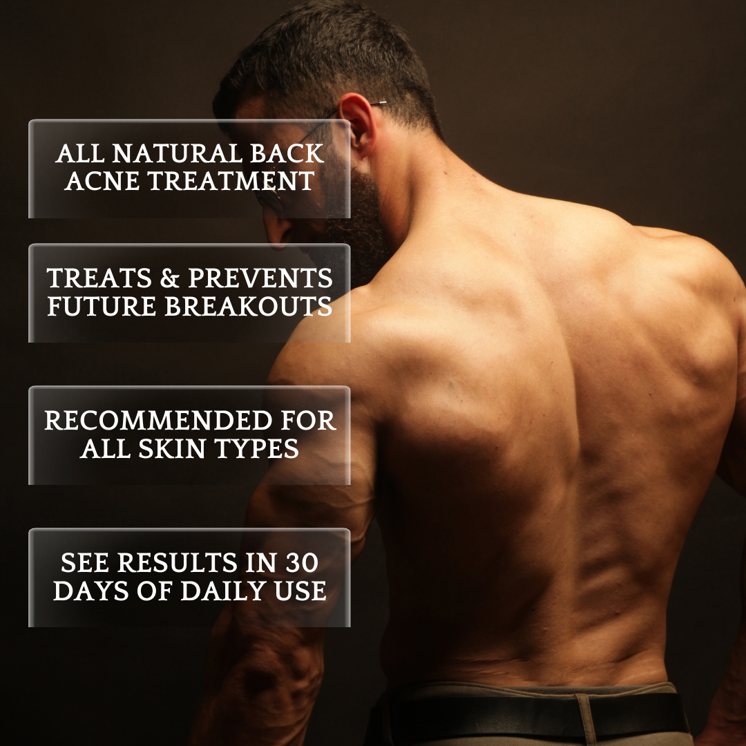 back acne body wash
