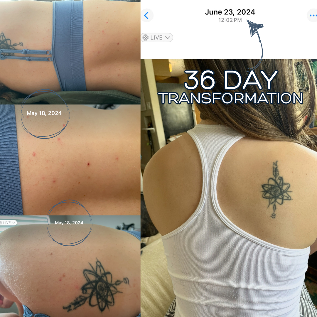 bacne wash testimonial